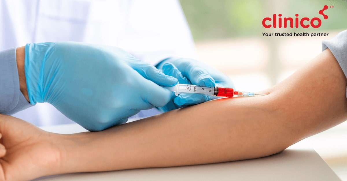 How to choose a Pathology Lab?