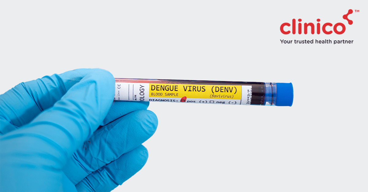 What are the necessary diagnostic tests for dengue?
