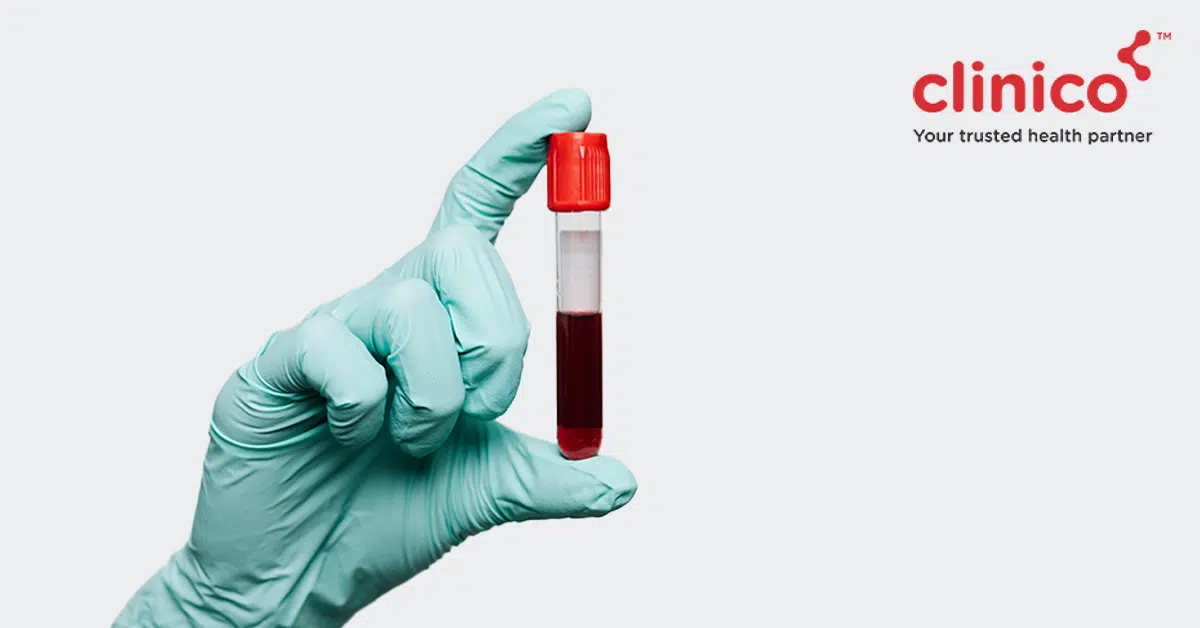 Why it is important to fast before certain blood tests?